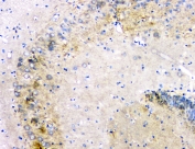 IHC staining of FFPE rat brain with Amyloid beta antibody at 1ug/ml. HIER: boil tissue sections in pH6, 10mM citrate buffer, for 10-20 min and allow to cool before testing.