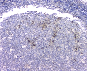IHC staining of FFPE human tonsil with Amyloid beta antibody at 1ug/ml. HIER: boil tissue sections in pH6, 10mM citrate buffer, for 10-20 min and allow to cool before testing.