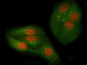 Immunofluorescent staining of FFPE human HeLa cells with c-Myc antibody (red) and Beta Tubulin mAb (green). HIER: steam section in pH6 citrate buffer for 20 min.
