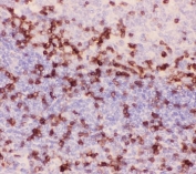 IHC-P: CD3 epsilon antibody testing of human tonsil tissue. Required HIER: steam section in pH6 citrate buffer for 20 min and allow to cool prior to testing.