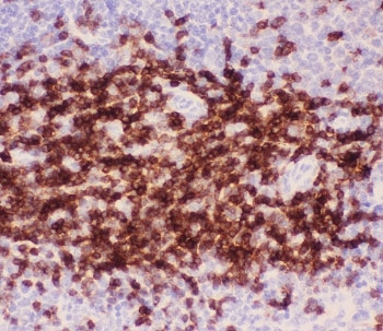 IHC-P: CD3 epsilon antibody testing of mouse spleen tissue