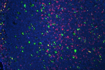 Immunofluorescent staining of FFPE human tonsil tissue with CD3 epsilon antibody (pink) and CD68 mAb (green) at 1ug/ml, and DAPI nuclear stain (blue). HIER: steam section in pH6 citrate buffer for 20 min.