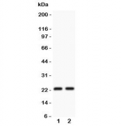 Western blot testing of CD3 epsilon antibody and Lane 1:  Jurkat;  2: CEM lysate.  Expected/observed molecular weight ~23 kDa.