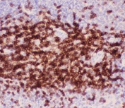 IHC-P: CD3 epsilon antibody testing of mouse spleen tissue. Required HIER: steam section in pH6 citrate buffer for 20 min and allow to cool prior to testing.