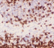 IHC-P staining of rat spleen tissue with CD3 epsilon antibody. Required HIER: steam section in pH6 citrate buffer for 20 min and allow to cool prior to testing.