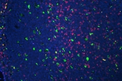 Immunofluorescent staining of FFPE human tonsil tissue with CD3 epsilon antibody (pink) and CD68 mAb (green) at 1ug/ml, and DAPI nuclear stain (blue). HIER: steam section in pH6 citrate buffer for 20 min.