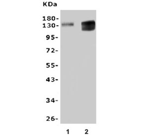 Western blot testing of human 1) Jurkat and 2) placenta lysate with CD31 antibody.  Expected molecular weight: 83~130 kDa depending on glycosylation level.