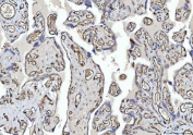 IHC staining of FFPE human placental tissue with CD31 antibody. HIER: boil tissue sections in pH8 EDTA for 20 min and allow to cool before testing.