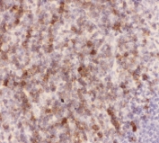 IHC-P: CD43 antibody testing of mouse spleen tissue. HIER: steamed with pH6 citrate buffer.