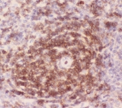 IHC-P: CD43 antibody testing of rat spleen tissue. HIER: steamed with pH6 citrate buffer.
