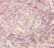 IHC-P: CD45 antibody testing of human tonsil tissue