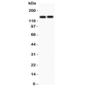 Western blot testing of CD45 antibody and Lane 1:  Jurkat;  2: Raji lysate.  Expected molecular weight: ~147/180-220 kDa (unmodified/glycosylated).
