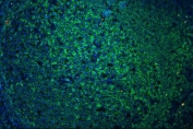 Immunofluorescent staining of FFPE human tonsil with CD45 antibody. HIER: boil tissue sections in pH6, 10mM citrate buffer, for 20 min and allow to cool before testing.