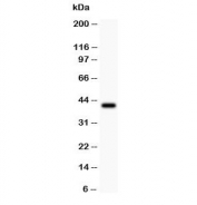 Western blot testing of Collagen IV antibody and  recombinant human partial protein 0.5ng.