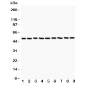 Western blot testing of CSK antibody (0.5ug/ml) and Lane 1:  rat testis;  2: (r) thymus;  3: mouse liver;  4: human HeLa;  5: (h) Jurkat;  6: (h) A549;  7: (h) MCF-7;  8: (m) NIH3T3;  9: (m) Neuro-2a lysate. Predicted molecular weight: ~50kDa.