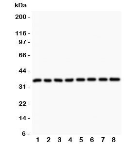 Western blot testing of Cyclin D3 antibody and Lane 1: rat testis; 2: (r) thymus; 3: (r) lung; 4: (r) ovary; 5: human Jurkat; 6: (h) A549; 7: (h) MCF-7; 8: (h) HeLa lysate