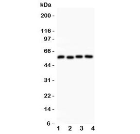 Western blot testing of Cyclin B1 antibody and Lane 1: HeLa; 2: 293T; 3: MCF-7; 4: COLO320 lysate. Predicted molecular weight: 48-60 kDa