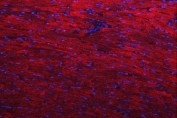 Immunofluorescent staining of FFPE rat heart tissue with Desmin antibody (red) and DAPI nuclear stain (blue). HIER: steam section in pH8 EDTA buffer for 20 min.