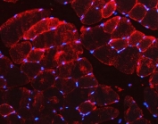 Immunofluorescent staining of FFPE mouse skeletal muscle tissue with Desmin antibody (red) and DAPI nuclear stain (blue). HIER: steam section in pH8 EDTA buffer for 20 min.