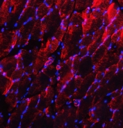 Immunofluorescent staining of FFPE rat skeletal muscle tissue with Desmin antibody (red) and DAPI nuclear stain (blue). HIER: steam section in pH8 EDTA buffer for 20 min.