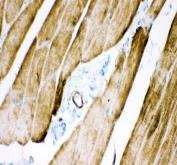 IHC staining of FFPE rat skeletal muscle tissue with Desmin antibody. HIER: boil tissue sections in pH8 EDTA for 20 min and allow to cool before testing.