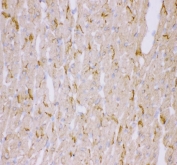 IHC staining of frozen rat heart tissue with Desmin antibody.