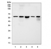 Western blot testing of 1) rat heart, 2) rat skeletal muscle, 3) rat C2C12, 4) mouse heart and 5) mouse skeletal muscle tissue lysate with Desmin antibody. Predicted molecular weight ~54 kDa.