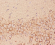 IHC-P: FSH beta antibody testing of mouse brain tissue