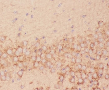 IHC-P: FSH beta antibody testing of mouse brain tissue