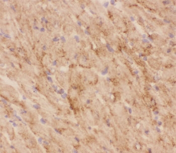 IHC-F testing of GLUT4 antibody and mouse heart tissue