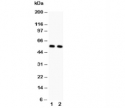 Western blot testing of GLUT4 antibody and Lane 1:  rat heart;  2: rat skeletal muscle. Predicted molecular weight: 45-55kDa.