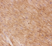 IHC-F testing of GLUT4 antibody and rat heart tissue