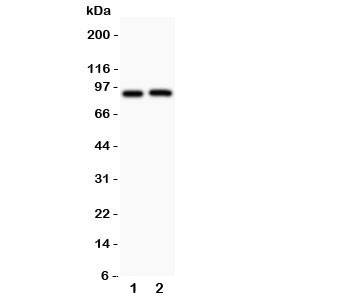 Western blot testing of Kv2.1 antibody and Lane 1: rat brain; 2: mouse brain