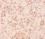 IHC-P staining of rat brain tissue