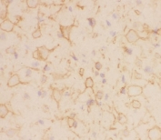 IHC-F staining of rat brain tissue