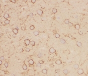 IHC-F staining of mouse brain tissue