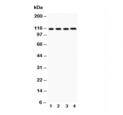 Western blot testing of NALP3 antibody and lysates from the human tumor cell lines 1:  HeLa;  2: MCF-7;  3: Jurkat;  4: HEPG2. Predicted molecular weight ~118 kDa.