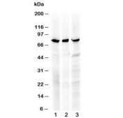 Western blot testing of human 1) PANC1, 2) SKOV-3 and 3) HeLa cell lysate (50ug/lane) with RIP1 antibody at 0.5ug/ml. Predicted molecular weight ~76 kDa.