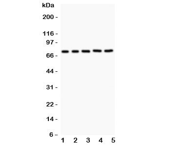 Western blot testing of RIP1 antibody and Lane 1: Jurkat; 2: 22RV1; 3: MCF-7; 4: HeLa; 5: A549. Expected/observed size ~76KD