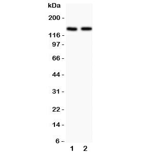 Western blot testing of Hamartin antibody and Lane 1: rat brain; 2: human HeLa lysate.  Expected/observed size 130KD~150KD~