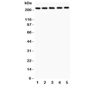Western blot testing of TSC2 antibody and human samples 1: U20S; 2: PANC; 3: HEPG2; 4: A549; 5: COLO320. Expected/observed size 200~220KD