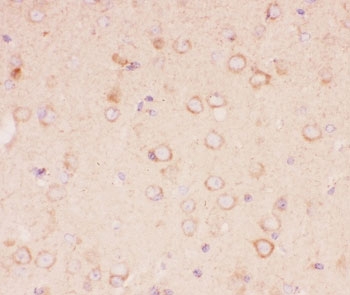 IHC-P: TSC2 antibody testing of mouse brain tissue