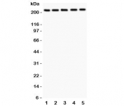 Western blot testing of TSC2 antibody and human samples 1:  U20S;  2: PANC;  3: HEPG2;  4: A549;  5: COLO320.  Expected/observed size 200~220KD