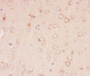 IHC-P: TSC2 antibody testing of mouse brain tissue