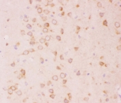 IHC-P: TSC2 antibody testing of rat brain tissue