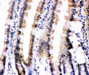 IHC-P: Ubiquitin antibody testing of mouse intestine tissue