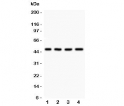 Western blot testing of AAMP antibody and Lane 1:  A431;  2: HeLa;  3: HEPG2;  4: MCF-7.  Expected molecular weight: ~47 kDa.