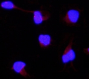 Immunofluorescent staining of FFPE human U-2 OS cells with AAMP antibody (red) at 2ug/ml and DAPI nuclear stain (blue). HIER: steam section in pH6 citrate buffer for 20 min.