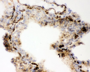 IHC staining of frozen mouse lung with ACE antibody.