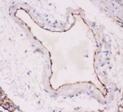 IHC-P testing of rat lung tissue with ACE antibody. HIER: boil tissue sections in pH6, 10mM citrate buffer, for 20 min and allow to cool before testing.